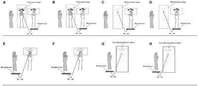Task Complexity and Image Clarity Facilitate Motor and Visuo-Motor Activities in Mirror Therapy in Post-stroke Patients